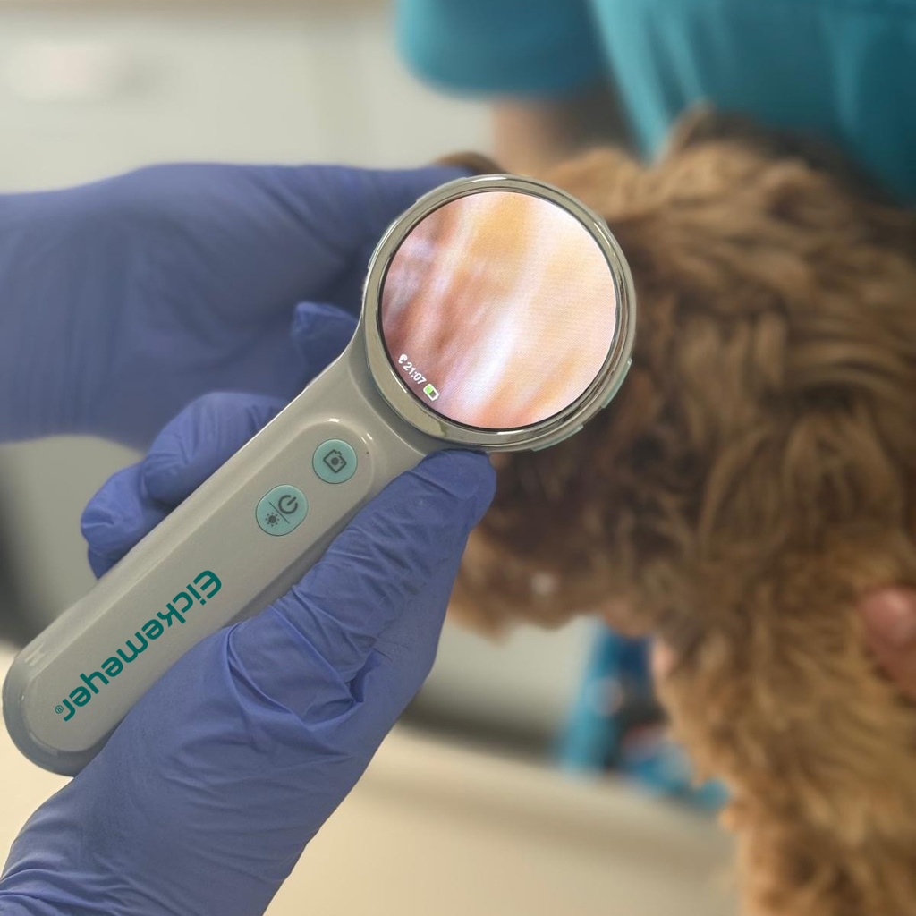 EickView OTO – digitalt video otoskop4